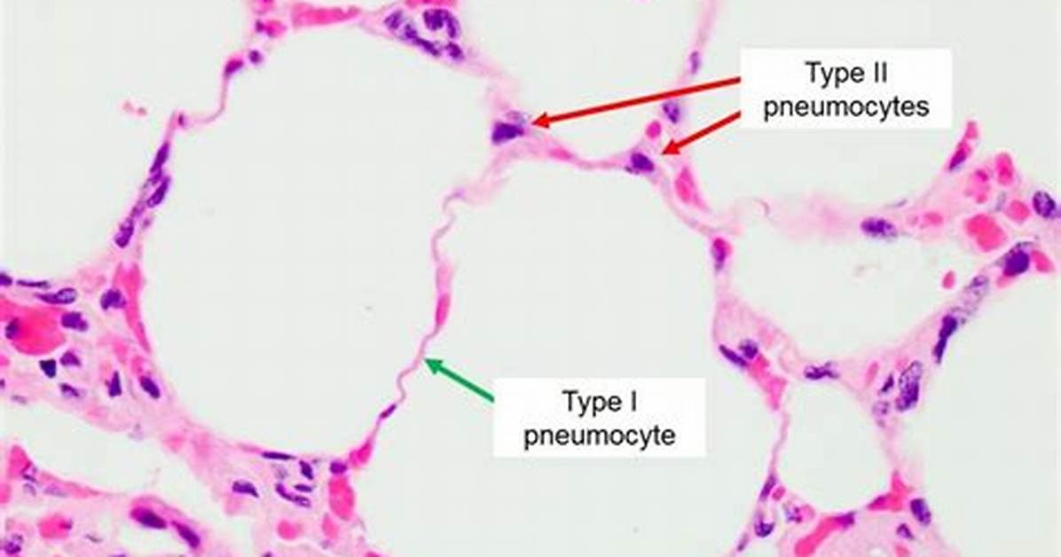Type 2 Pneumocytes