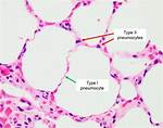 Type 2 Pneumocytes