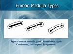 Types of Medulla