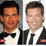 Understanding Harry Connick Jr. Stroke: a Deep Dive into His Health Journey