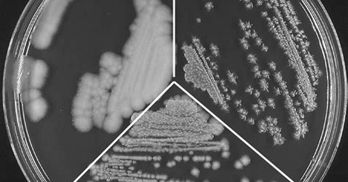 Understanding Multiple Bacterial Morphotypes in Urine