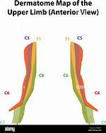 Upper Limb Dermatomes