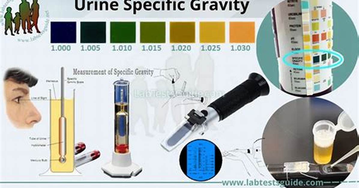 Urinalysis Specific Gravity