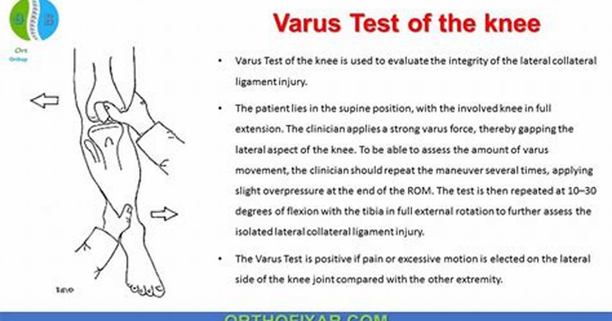 Varus Stress Test