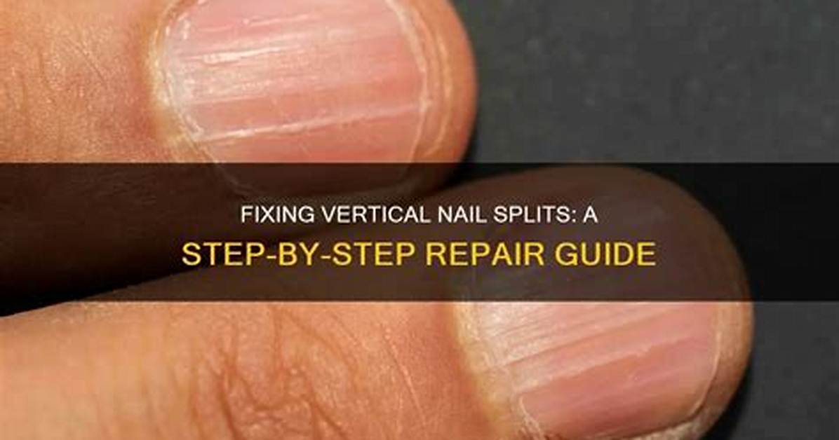 Vertical Nail Split