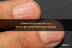 Vertical Nail Split