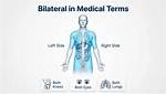 Was Does Bilateral Mean?