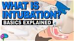 Was Does Intubated Mean?
