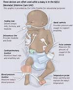 Was Does Neonatal Mean?