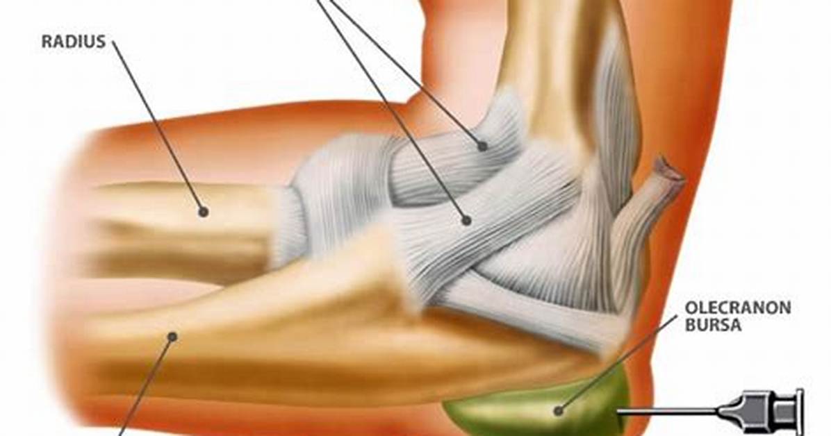 Weenus Elbow