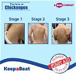 Were Do Chickenpox Start?