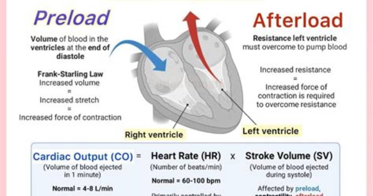 What Affects Preload