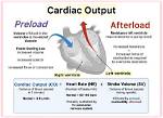 What Affects Preload