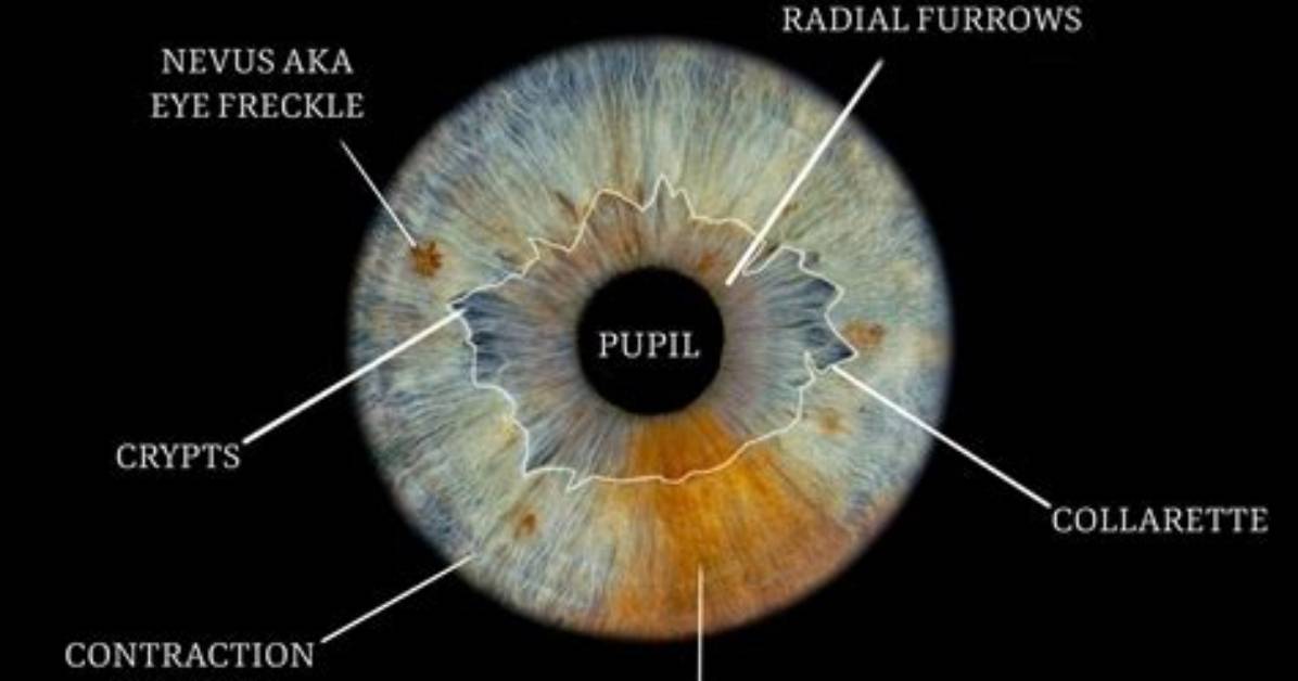 What Are Iris Crypts