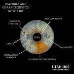 What Are Iris Crypts