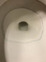 What Causes Blue Ring Around Toilet Bowl?