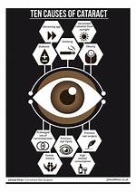 What Causes Cataract