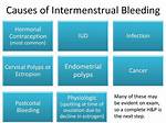 What Causes Intermenstrual Bleeding