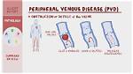 What Causes Pvd