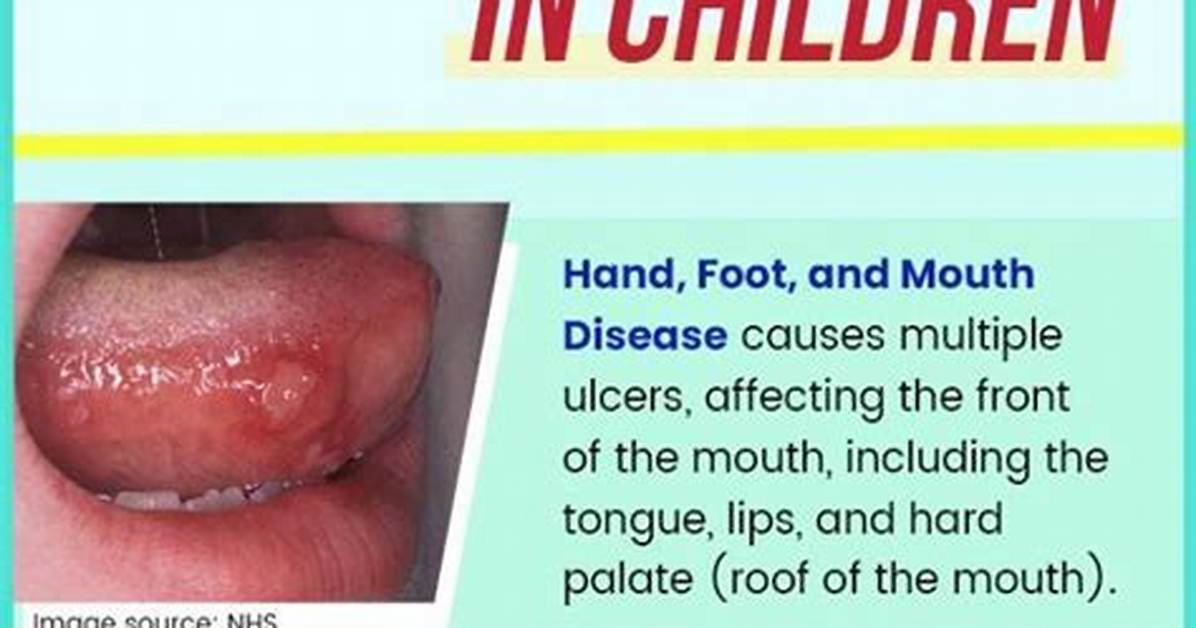 What Causes Split Mouth?