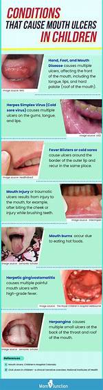 What Causes Split Mouth?