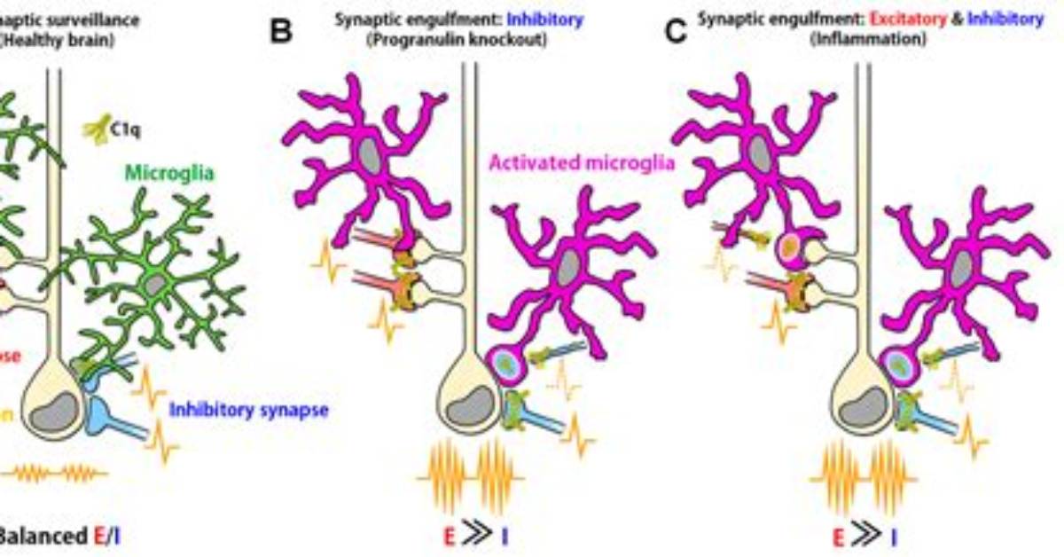 What Causes Synaptic Pruning?
