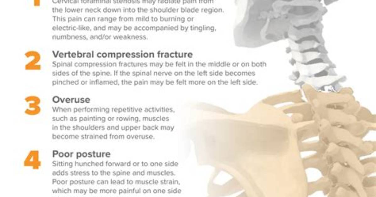 What Causes Upper Backaches?