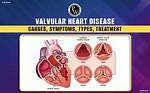 What Causes Valvulitis