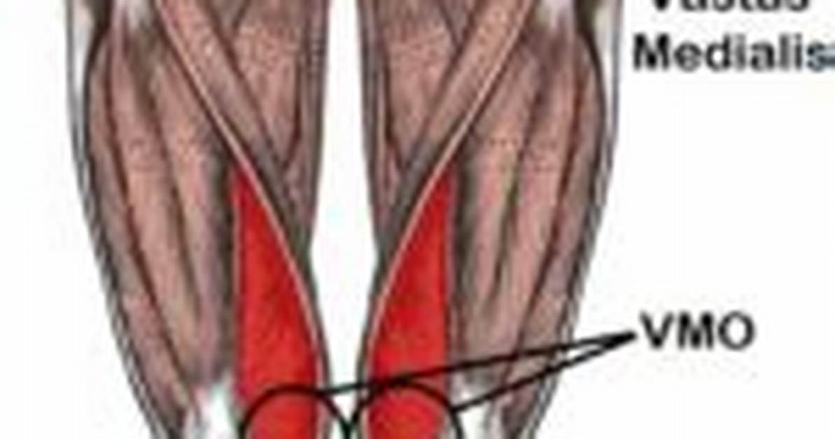 What Causes Vmo Weakness