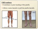 What Causes Vmo Weakness