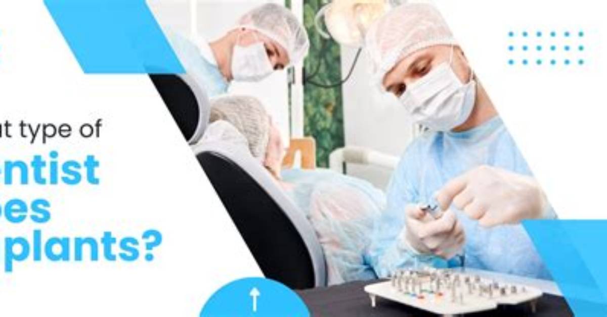What Dentist Does Implants?