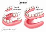 What Dentures Replace