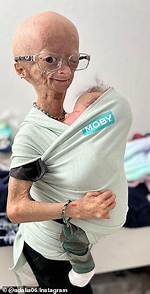 What Did Benjamin Button Have