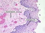What Do Amyloids Do?