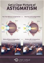 What Do Astigmatisms Do?