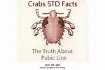 What Do Crabs Std Look Like
