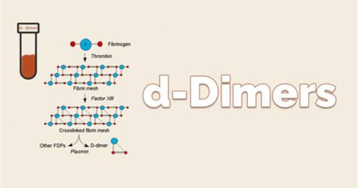 What Do Dimers Do?