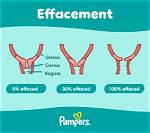 What Do Effaced Mean?
