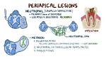 What Do Pathosis Mean?