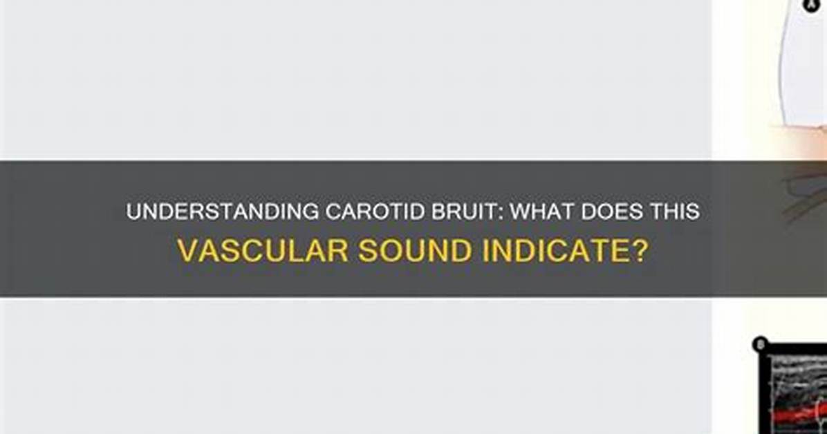 What Does a Bruit Indicate