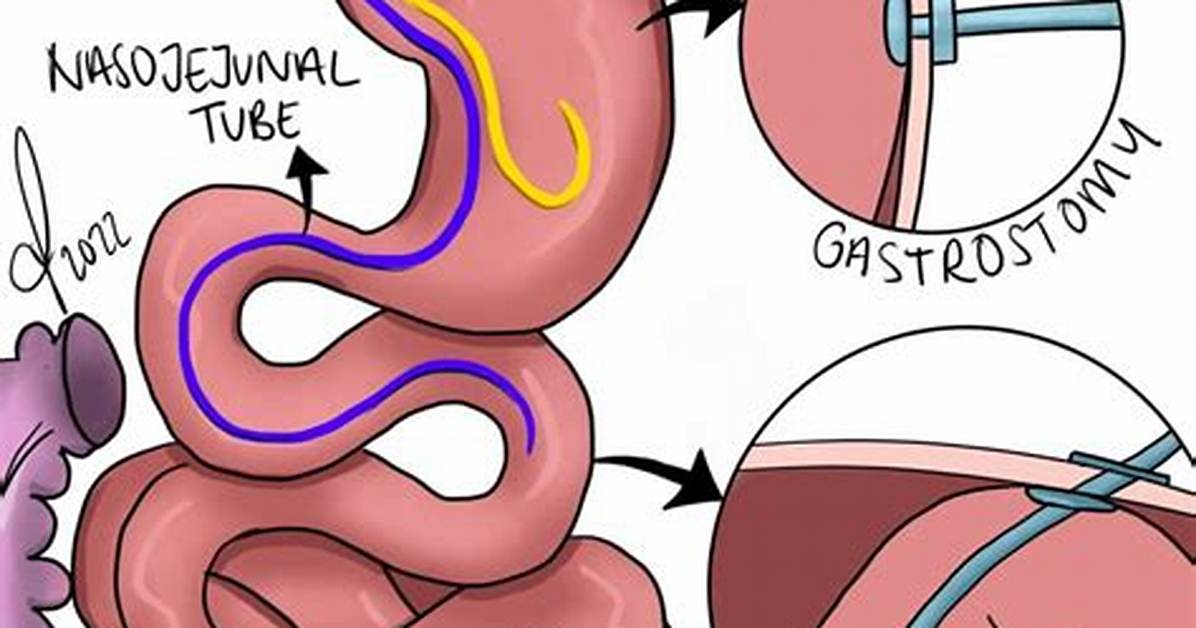What Does a Enterotomy Do?