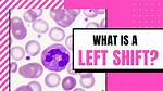 What Does a Left Shift Mean