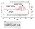 What Does a Spirometer Trace Show?
