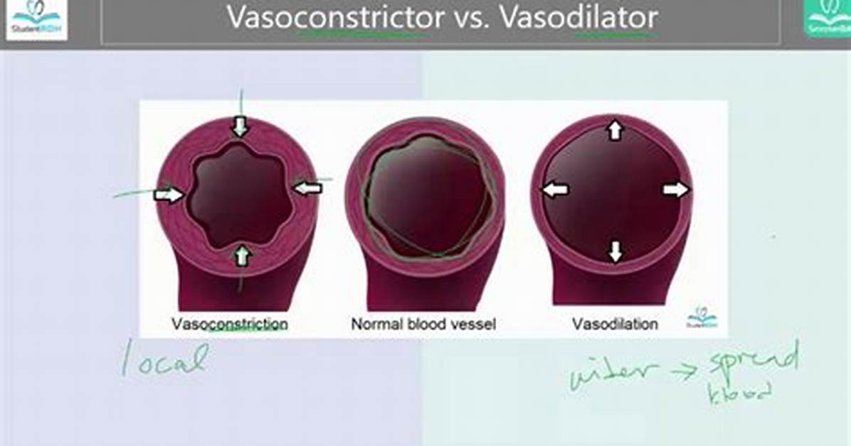 What Does a Vasoconstrictor Do?