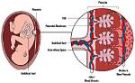 What Does Abnormal Placenta Mean?