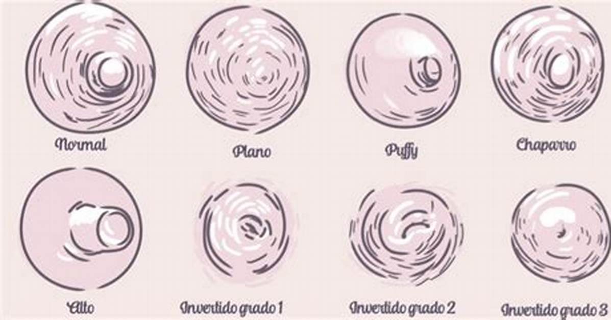 What Does Areolas Mean?