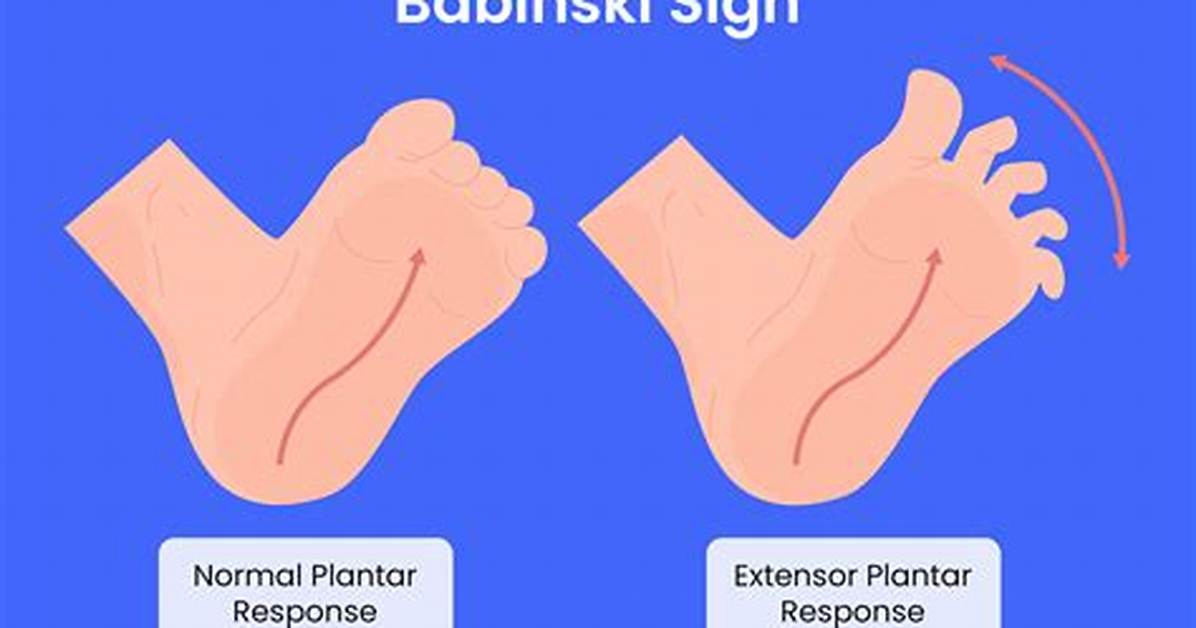 What Does Babinski Mean?