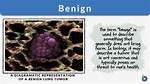 What Does Benignity Definition?