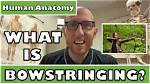 What Does Bowstringing Meaning?