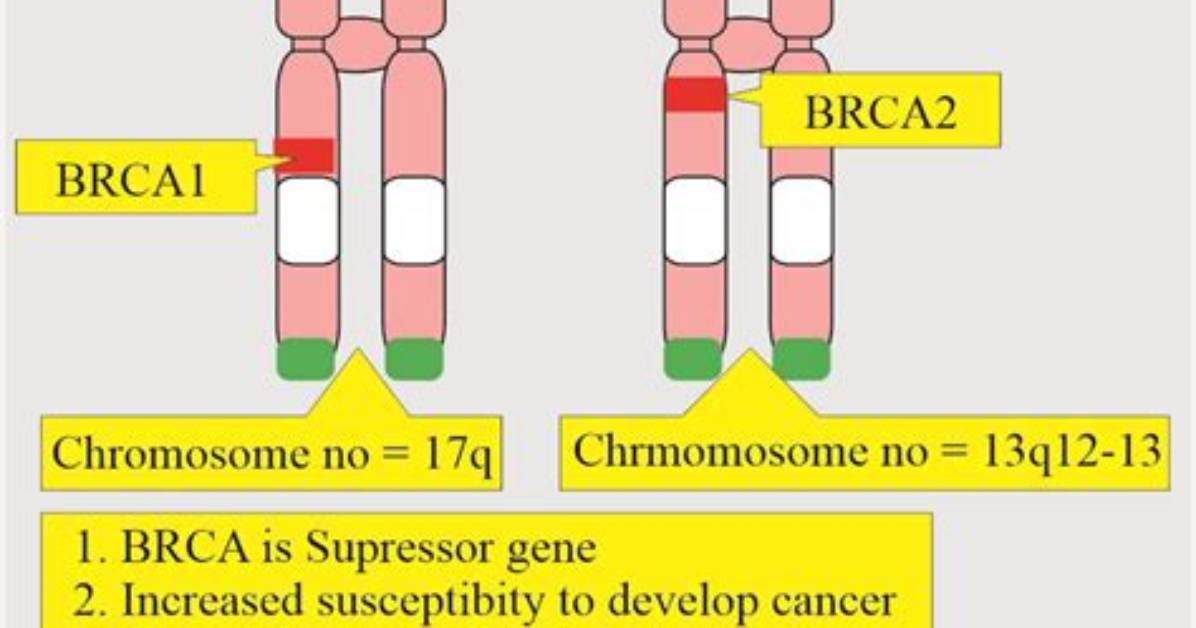 What Does Brca1 Stand for?